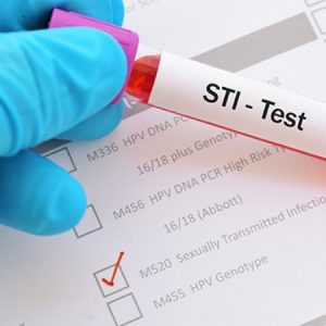 Every Crucial Facts about STI Testing You Need to Know